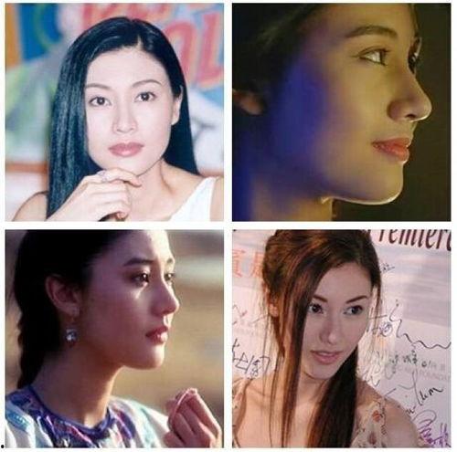 肉鼻子明星,揭秘娱乐圈中的独特魅力