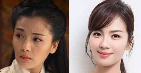 脸形不正的明星,脸形不正明星的蜕变之路